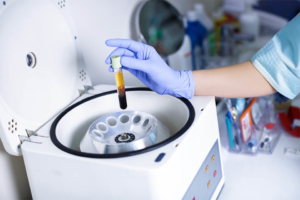 Ingénierie-tissulaire